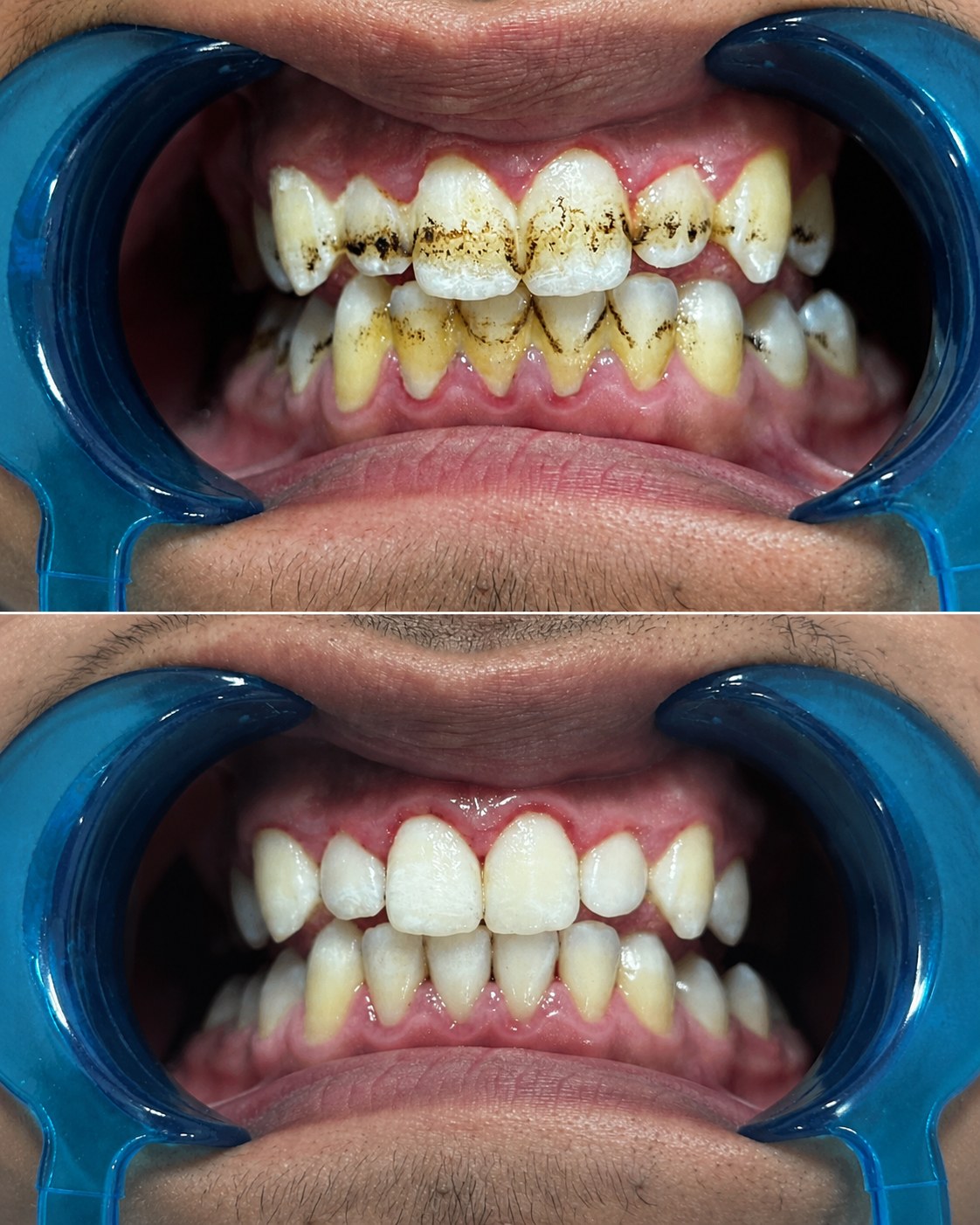 د.عبيدة كريم — أخصائي طب وجراحة الفم والأسنان — عمل 3