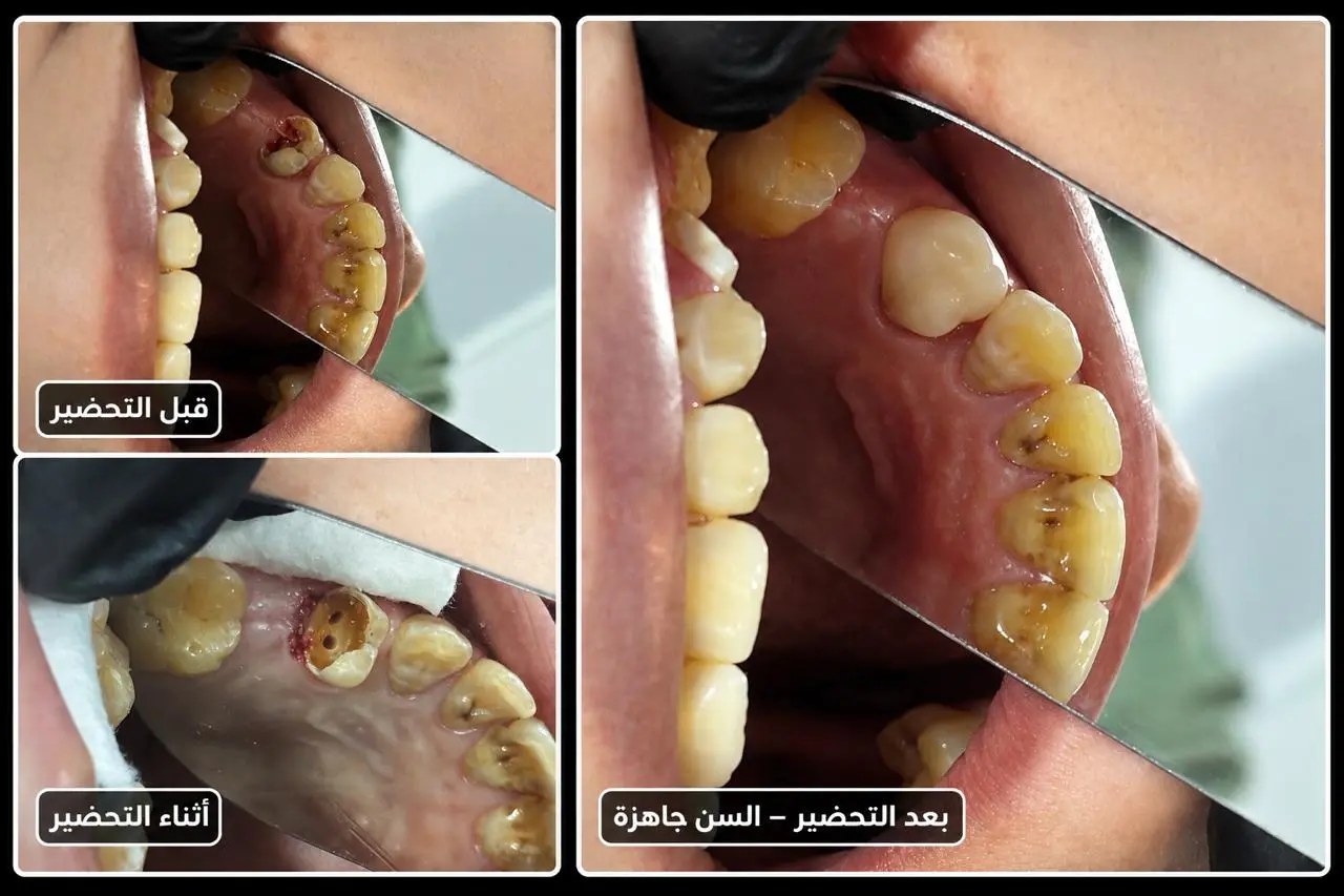 د.عبيدة كريم — أخصائي طب وجراحة الفم والأسنان — عمل 2